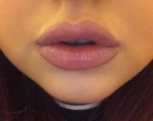 Aesthetox Glasgow - Aesthetics clients' results