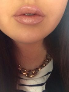 Aesthetox Glasgow - Aesthetics clients' results